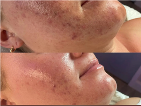 gallery image in our gallery