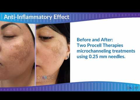 gallery image in our gallery