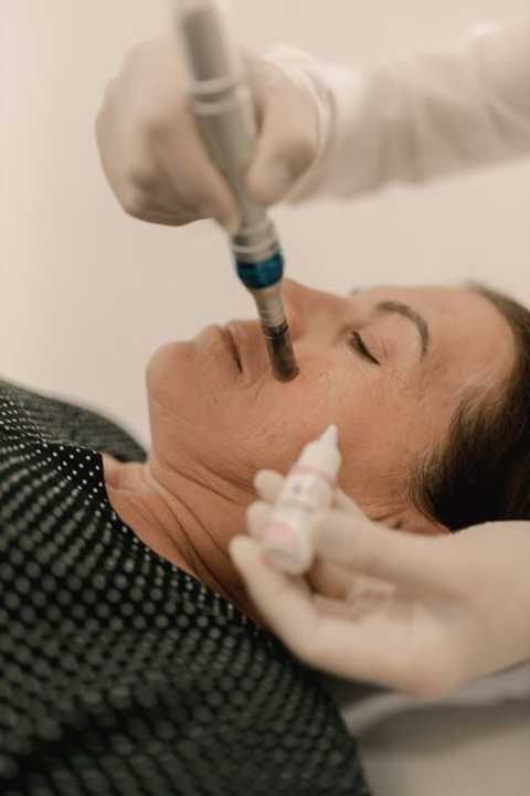 Medical Microneedling