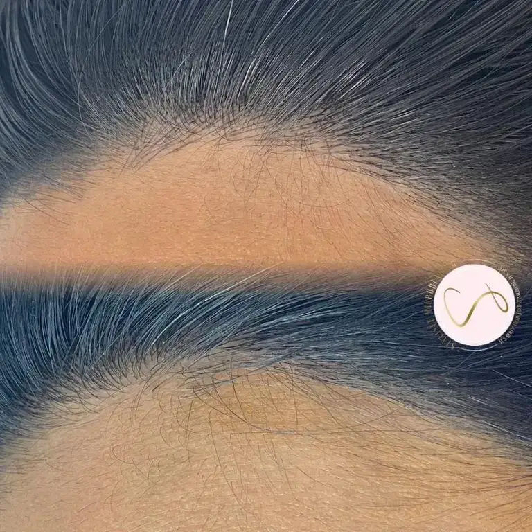 Hairlines Plus