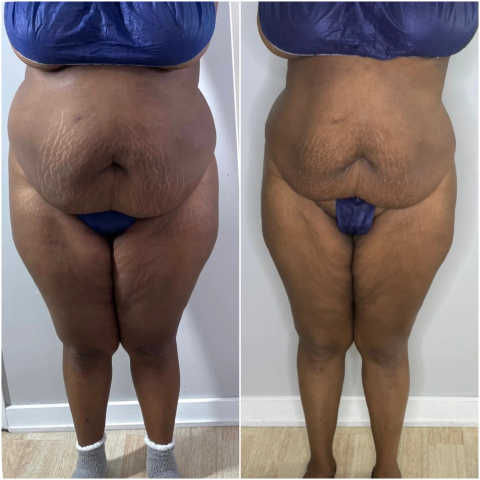 gallery image in our gallery