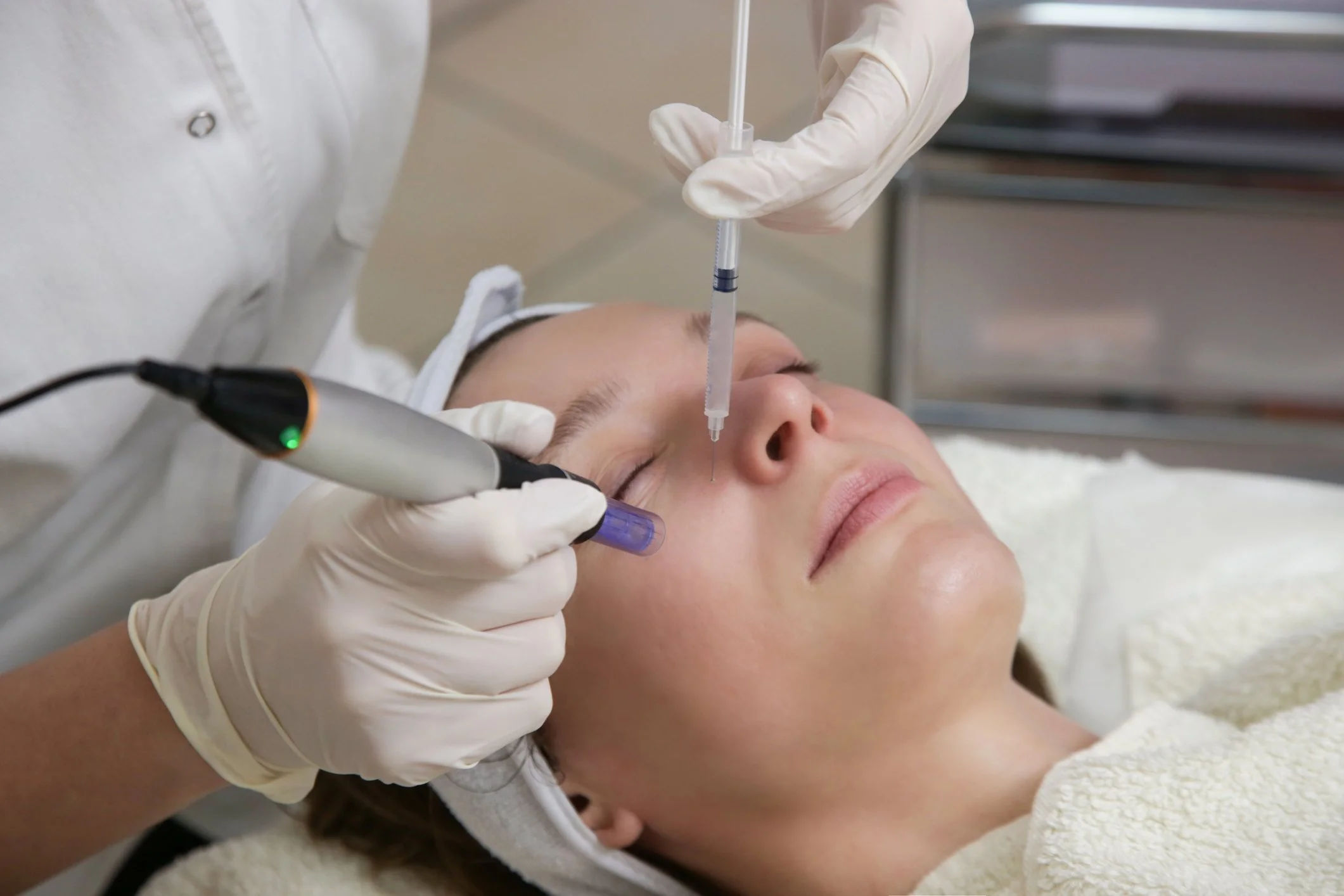 Microneedling Treatments