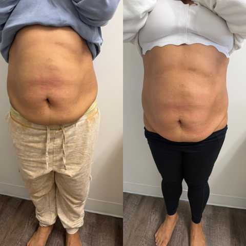 gallery image in our gallery