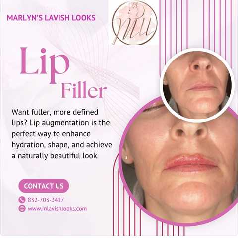 gallery image in our gallery