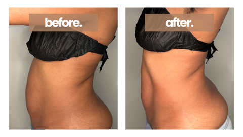 Ab-Define