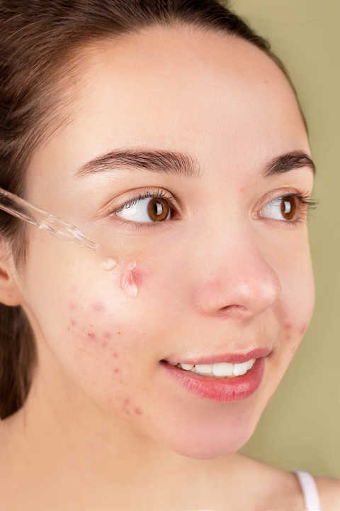 Acne and Scar Treatment service