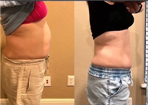 gallery image in our gallery