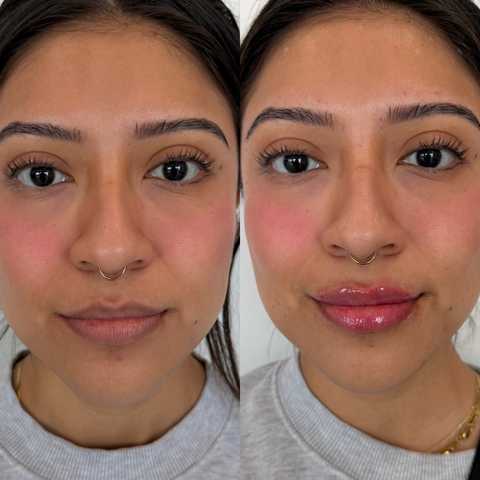 gallery image in our gallery