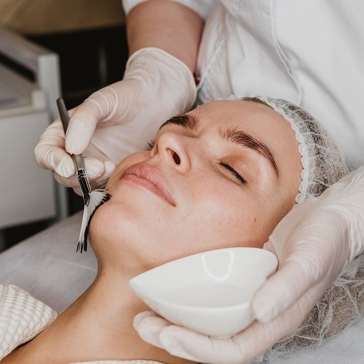 Chemical Peel
