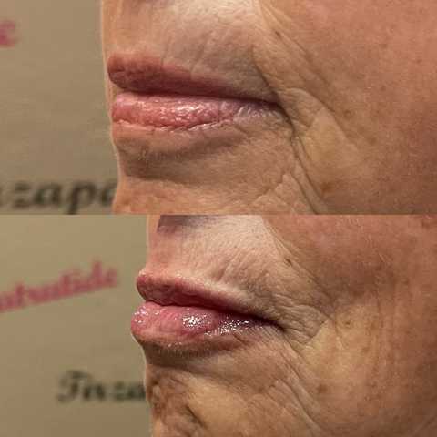 gallery image in our gallery