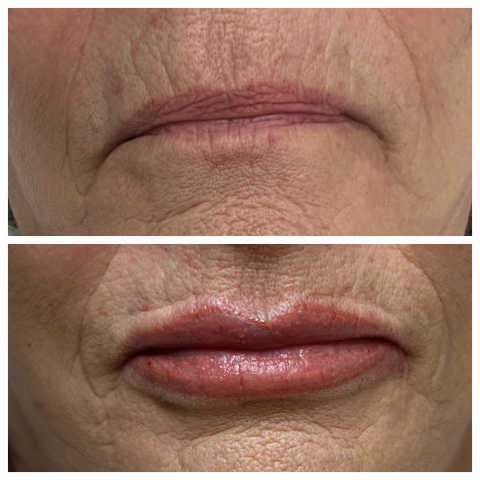 gallery image in our gallery