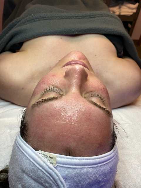 gallery image in our gallery