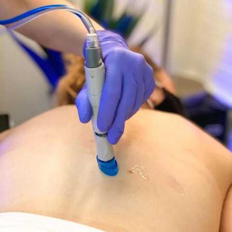 Hydrafacial Treatments service