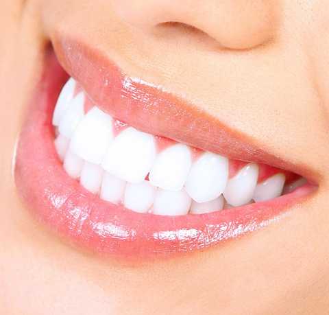 Teeth Whitening service