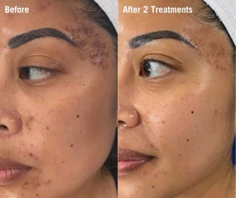 gallery image in our gallery