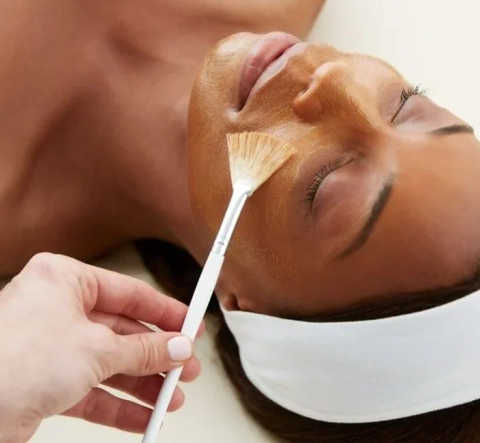Chemical Peels service