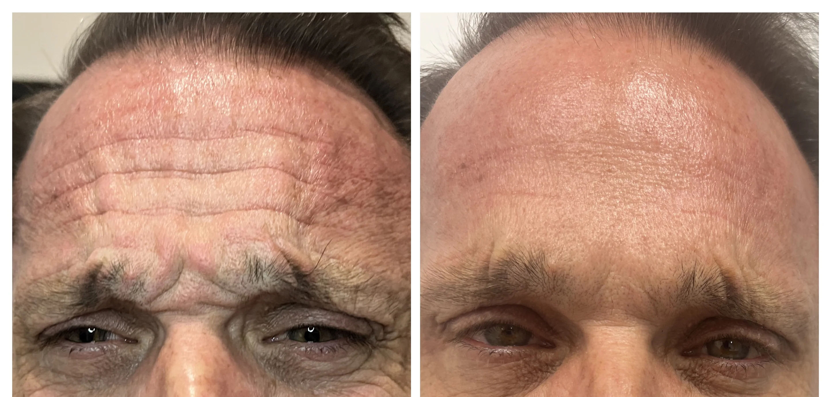 before and after,skincare,transformation,comparison