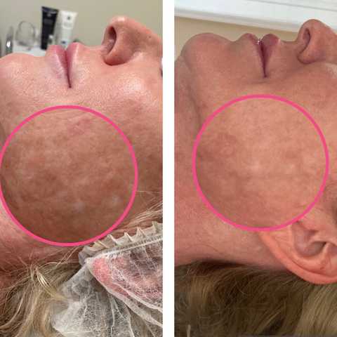 gallery image in our gallery