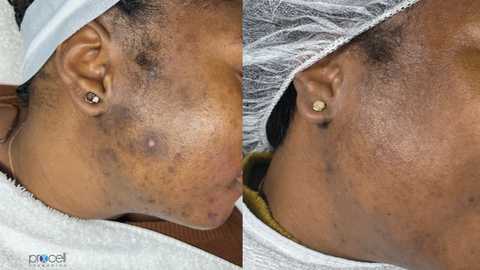 gallery image in our gallery