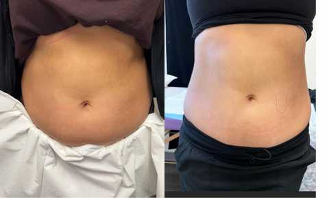 gallery image in our gallery