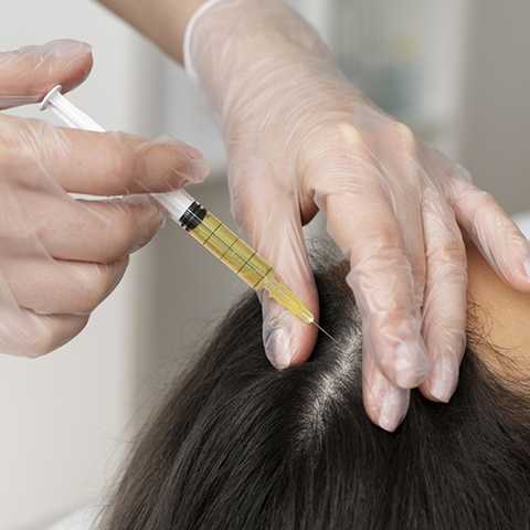 Hair Loss Treatments service