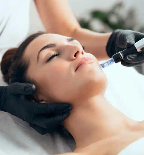 Microneedling service