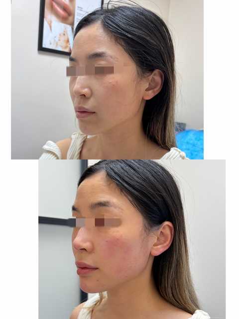 gallery image in our gallery