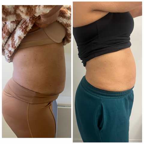 gallery image in our gallery