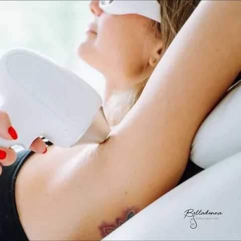 Underarms hyperpigmentation treatment