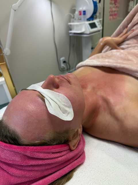 Facial & Peeling with PRX T33 service image