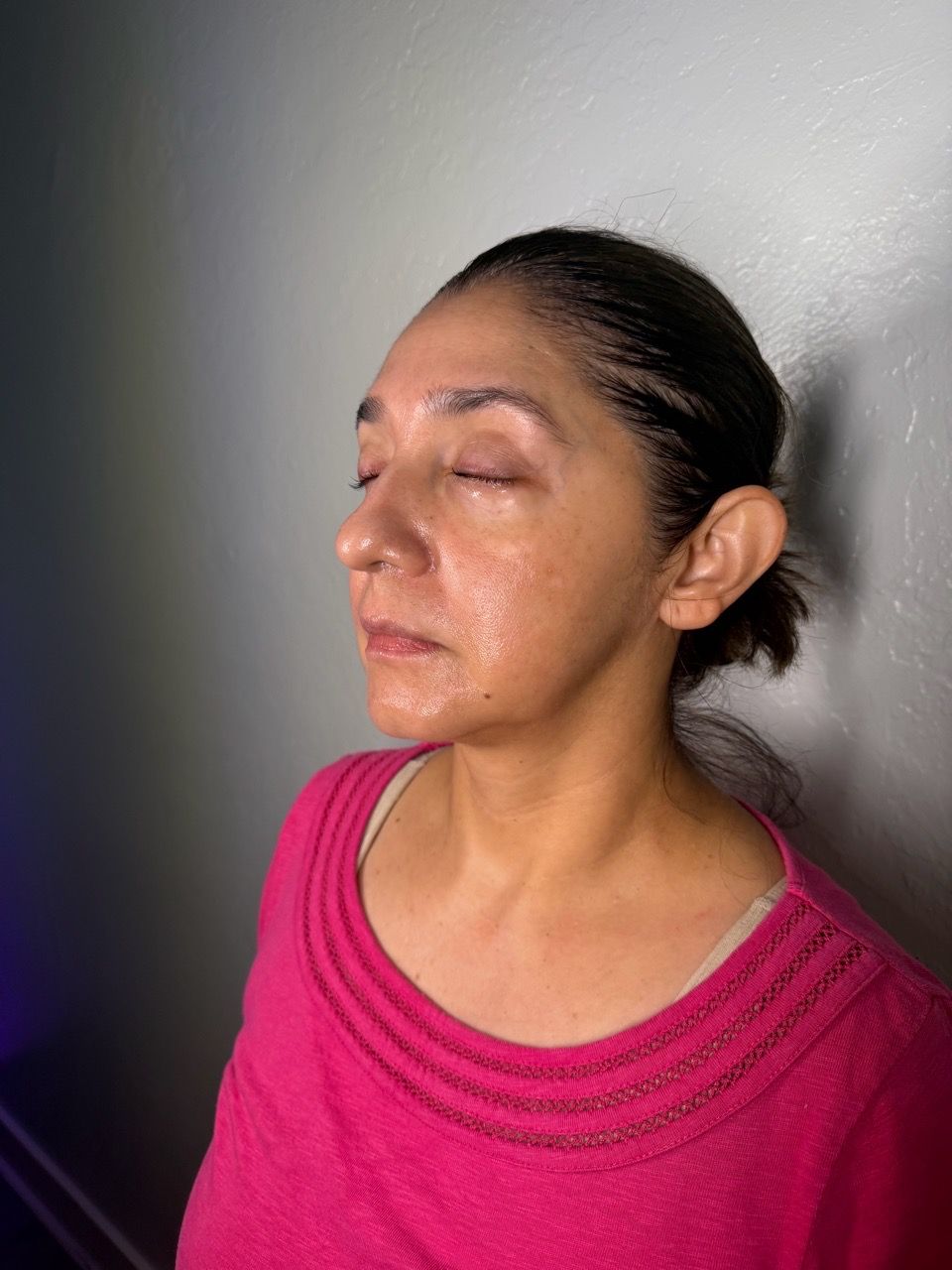  facial-treatment,skincare,glowing-skin,client-result,close-up,beauty-wellness,portrait,treatment-documentation 