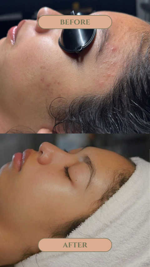 gallery image in our gallery