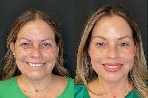 gallery image in our gallery