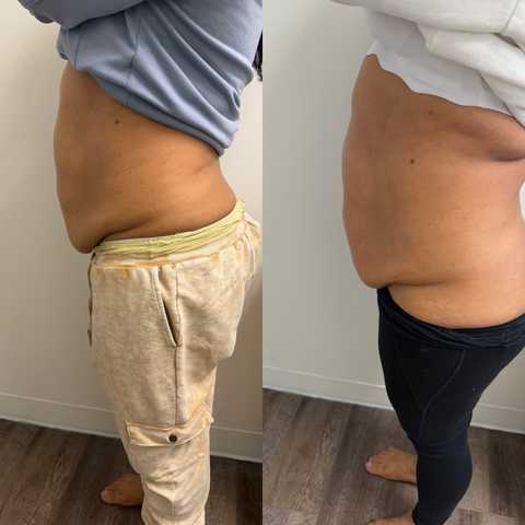 gallery image in our gallery