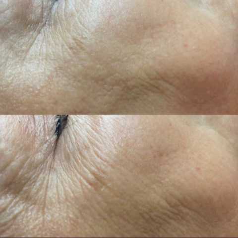 gallery image in our gallery