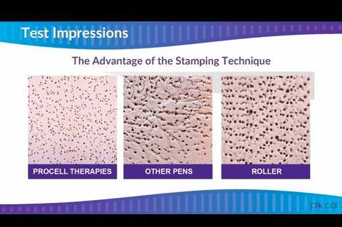 gallery image in our gallery