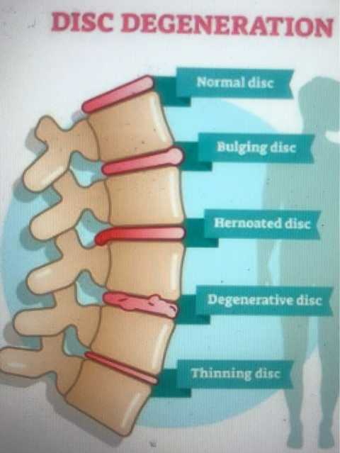 gallery image in our gallery