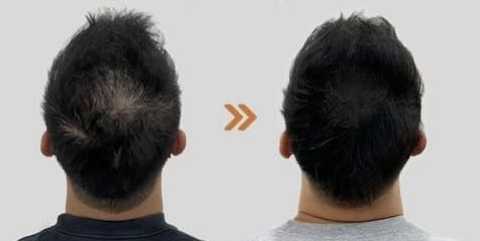 gallery image in our gallery