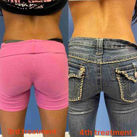 gallery image in our gallery