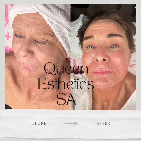 gallery image in our gallery