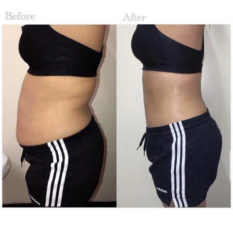 gallery image in our gallery