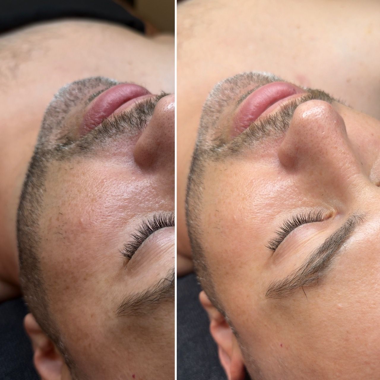 eyebrows,brow-transformation,before-and-after,beauty-treatment,facial-close-up,cosmetic-enhancement,client-result