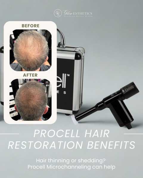 Hair Restoration service