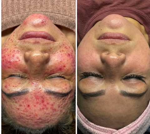 gallery image in our gallery