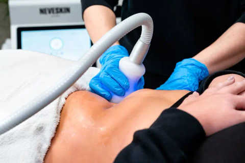 NEVESKIN™ Treatments service