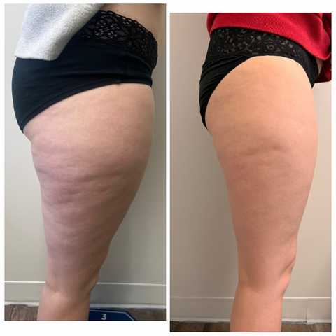 gallery image in our gallery