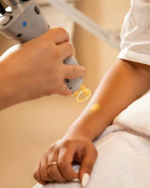 Laser Tattoo Removal