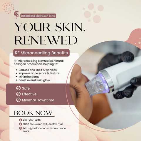 RF Microneedling