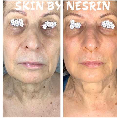 gallery image in our gallery