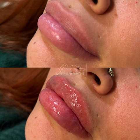 gallery image in our gallery